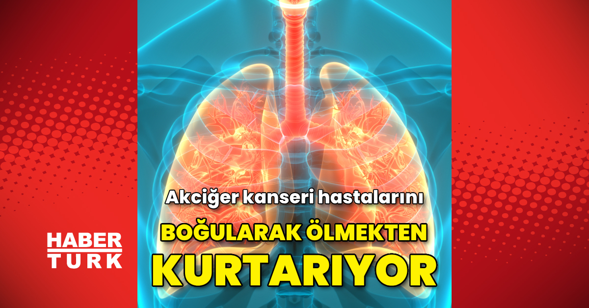 Akciğer kanseri hastalarını boğularak ölmekten kurtaran yöntem