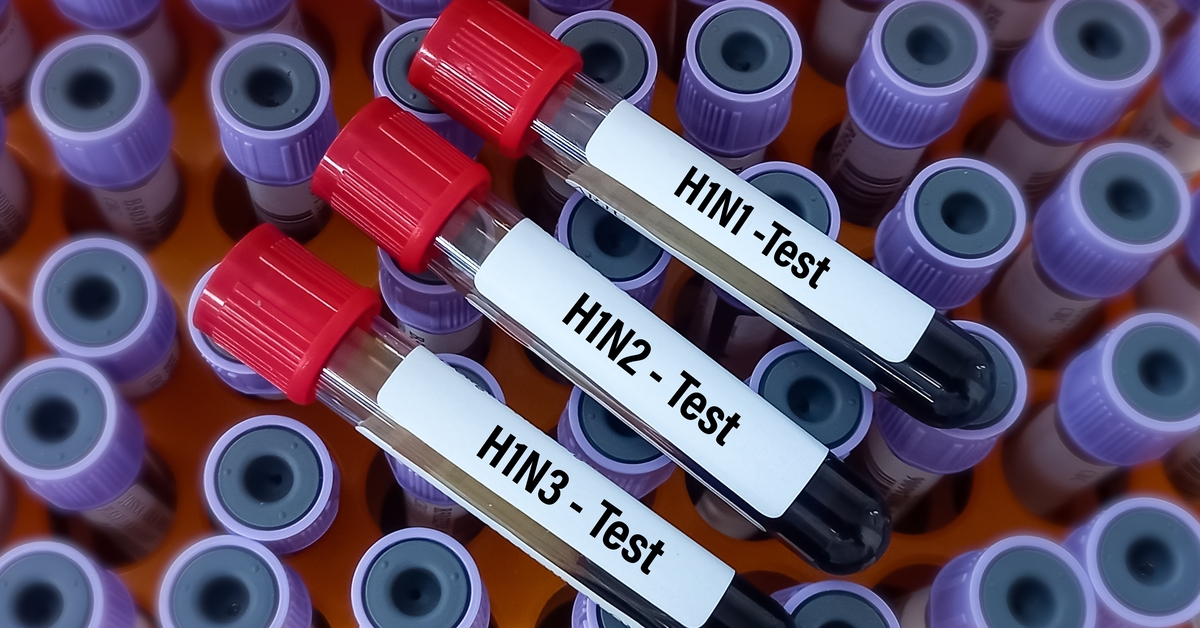 İngiltere'de H1N2 grip türü ilk kez insanda görüldü