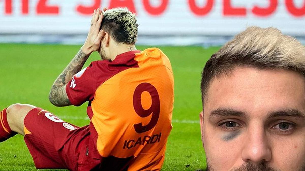 Fenerbahçe derbisinde yüzünü direğe çarpan Mauro Icardi'de kırık şüphesi! Süper Kupa'da oynayacak mı?