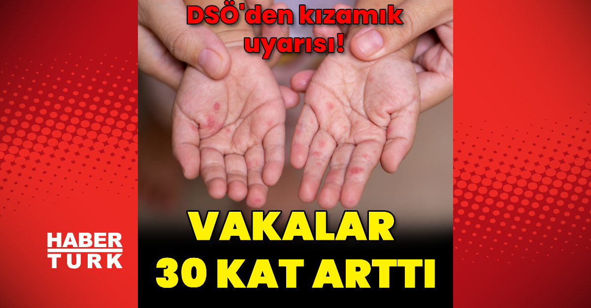 DSÖ Avrupa’dan kızamık uyarısı: Vakalar 2023’te 30 kat arttı