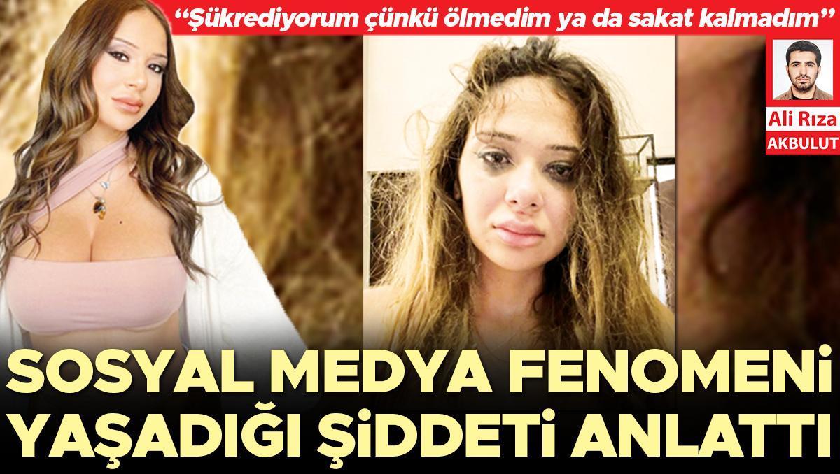 Sosyal medya fenomeni yaşadığı şiddeti anlattı