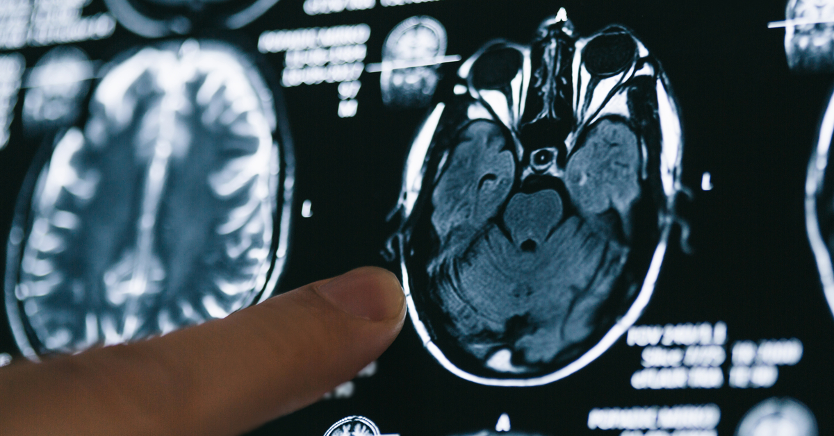 Fransa'da dünyanın en güçlü MRI cihazıyla çekilen insan beyninin en net görüntüsü yayınlandı