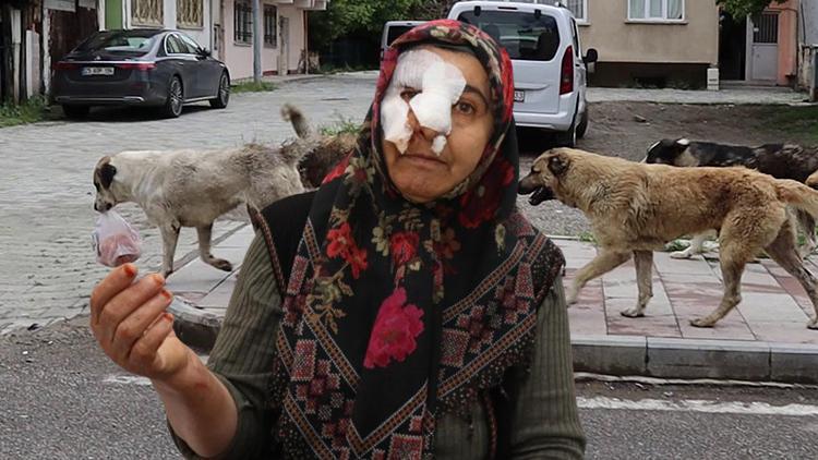 Sokak köpeklerinden kaçmaya çalışan kadının kolu ve burnu kırıldı