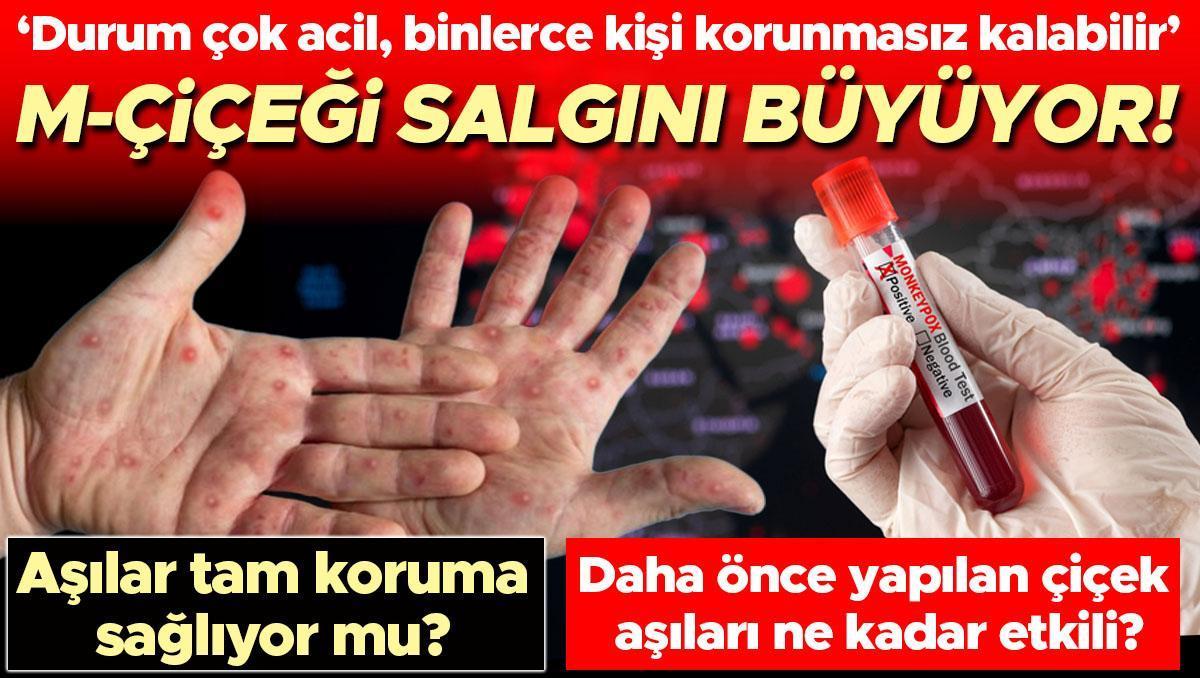 M-Çiçeği salgını büyüyor! Aşılar tam koruma sağlıyor mu? Önceki çiçek aşıları virüse karşı ne kadar etkili? ‘Durum çok acil, binlerce kişi korunmasız kalabilir’