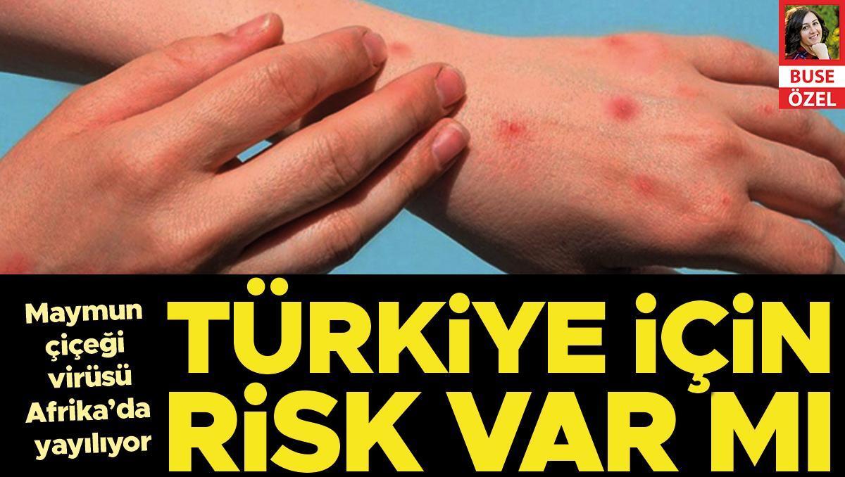 Maymun Çiçeği Virüsü Afrika’da yayılıyor... Türkiye için risk var mı