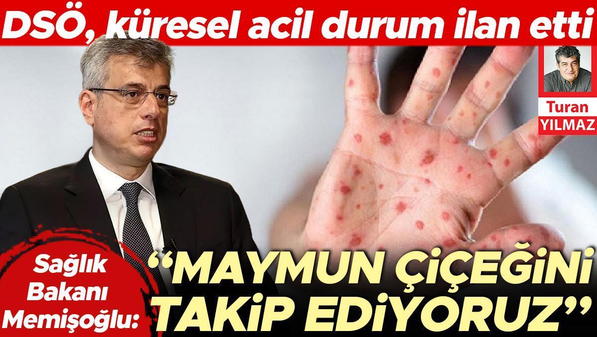 Sağlık Bakanı Memişoğlu: Maymun çiçeğini takip ediyoruz