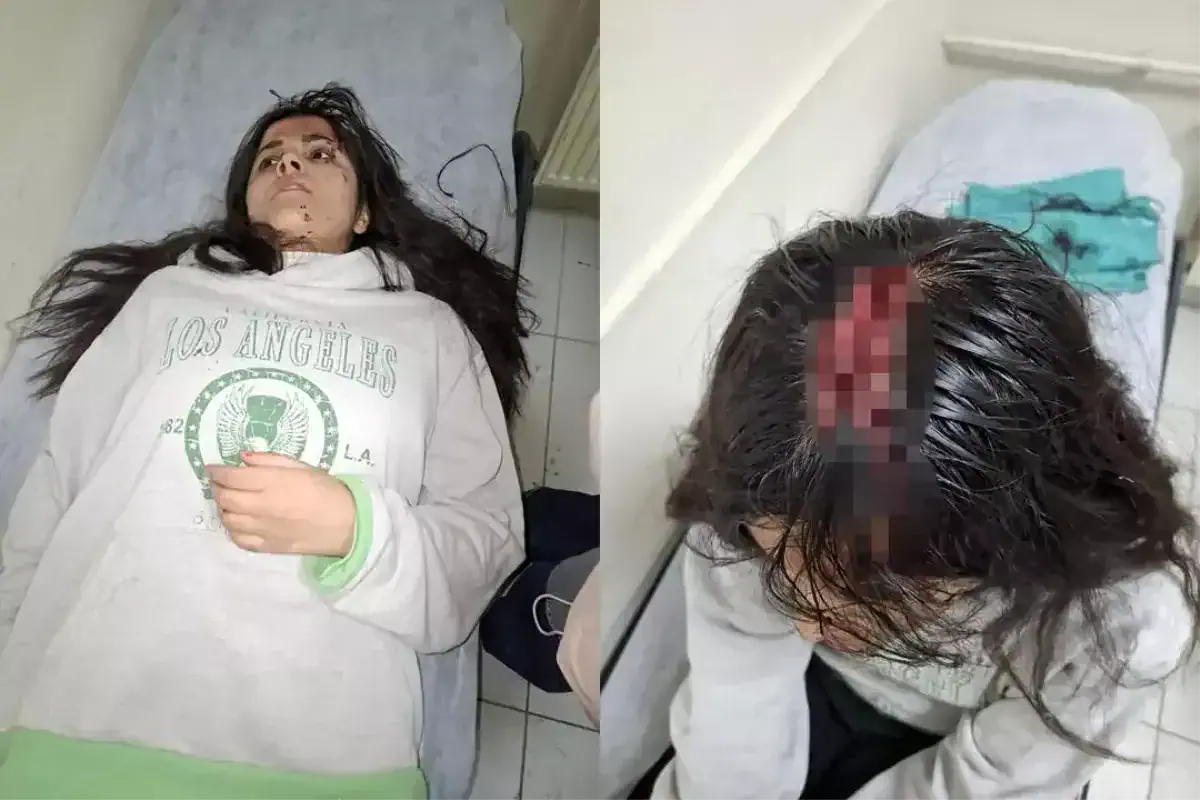 Hakkari'de Buz Kütlesi Düşmesi Sonucu Genç Kız Yaralandı